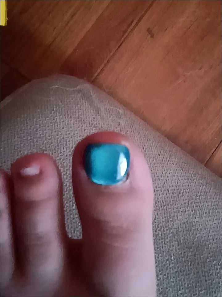 Teal Cat Eye Square Press-On Toenails — customer review photo