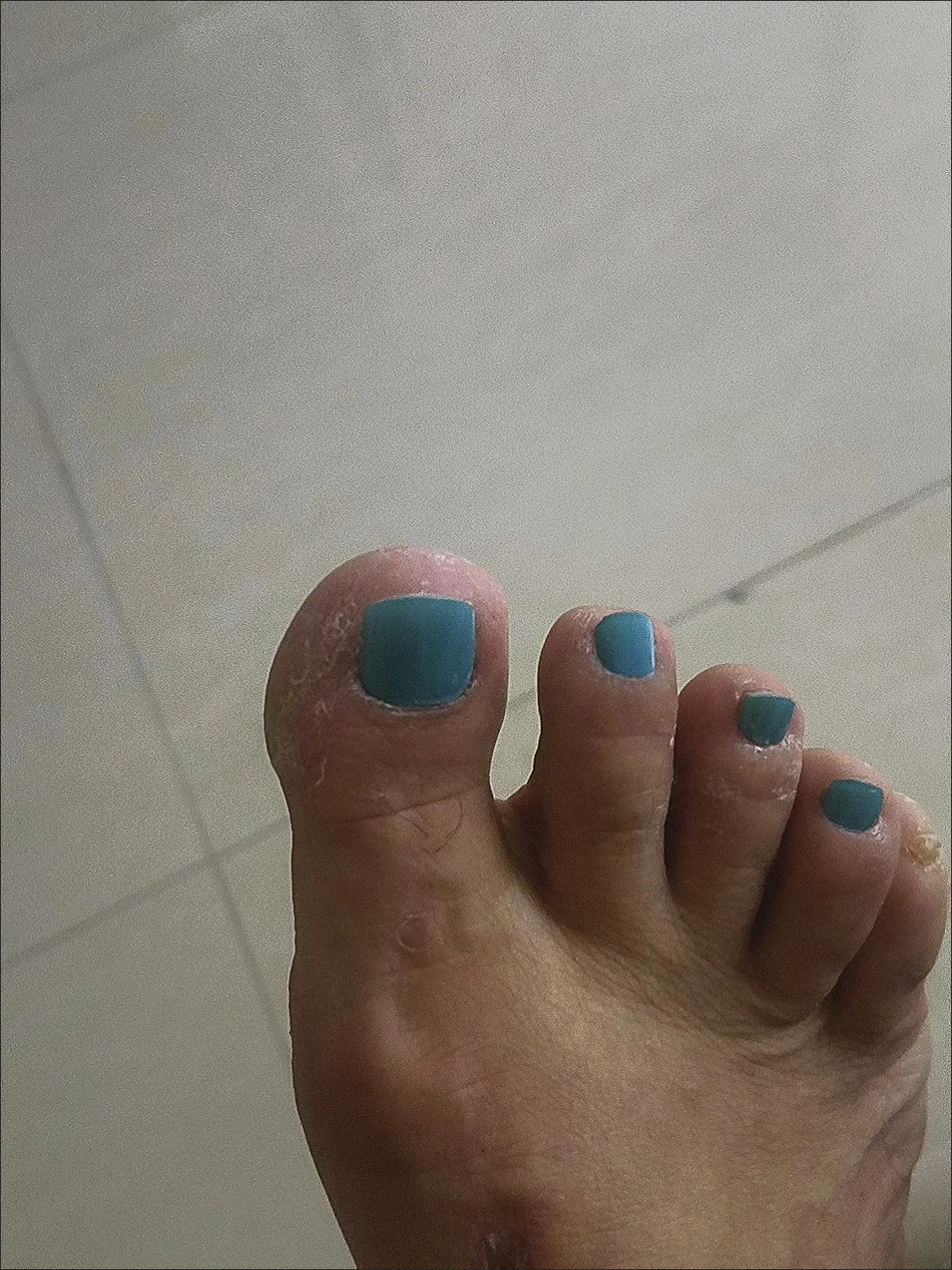 Turquoise Glossy Square Press-On Toenails — customer review photo